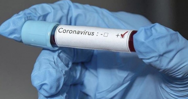 За сутки в Магадане и регионе зарегистрировано 4 новых  случая заражения коронавирусом