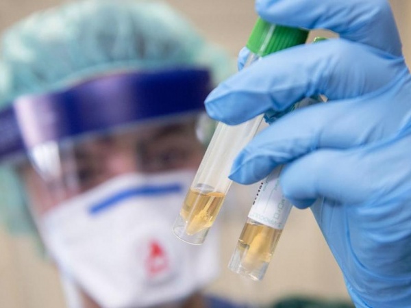За сутки в Магадане и регионе зарегистрировано 16 новых  случаев заражения коронавирусом