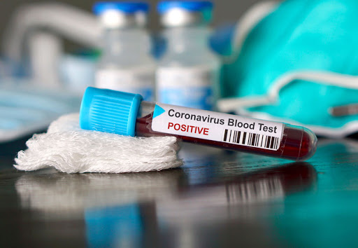 За сутки в Магадане и регионе зарегистрировано 36 новых  случаев заражения коронавирусом