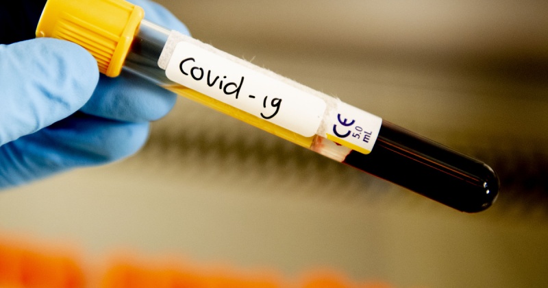 За сутки в Магадане и регионе зарегистрировано 31 новый  случай заражения коронавирусом
