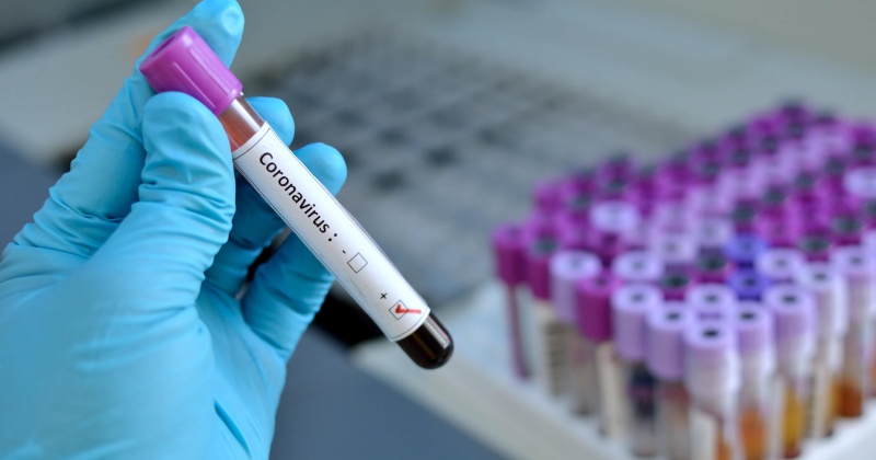 47  новых  случаев заражения коронавирусом на Колыме