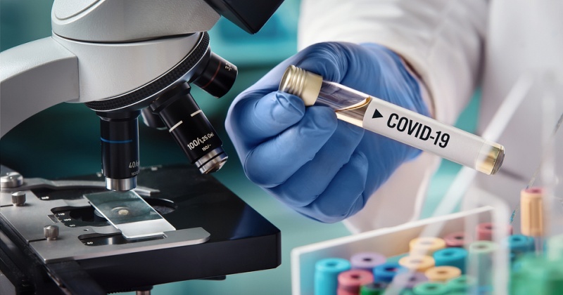 Две смерти и 25  новых  случаев заражения коронавирусом на Колыме