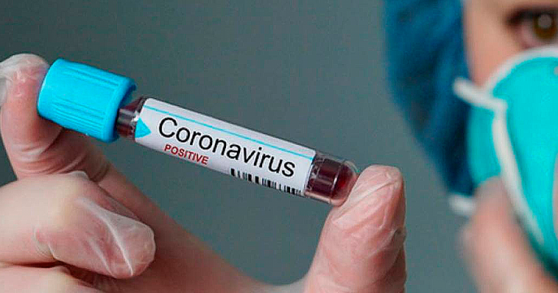 21 новый  случай заражения коронавирусом на Колыме