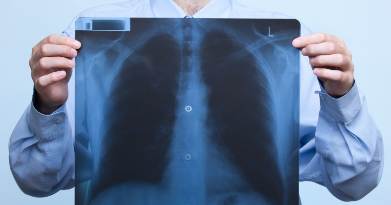 На портале Госуслуг магаданцы теперь могут записаться к врачу рентгенологу
