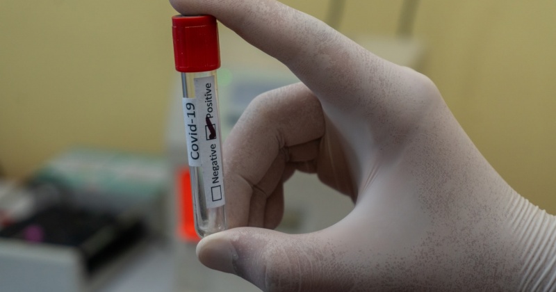 25 новых случаев заболевания коронавирусом на Колыме