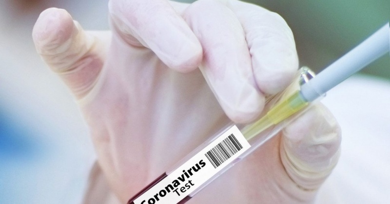 За сутки на Колыме выявлено 23 лабораторно подтверждённых случая заболеваний коронавирусом