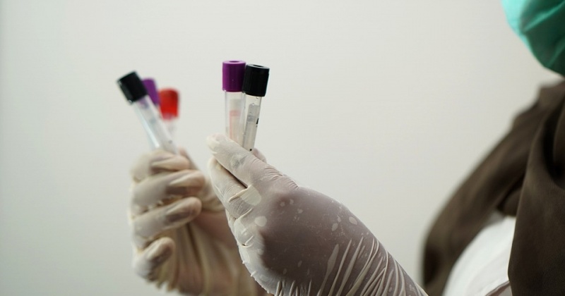 10  новых случаев заболевания коронавирусом выявлено на Колыме