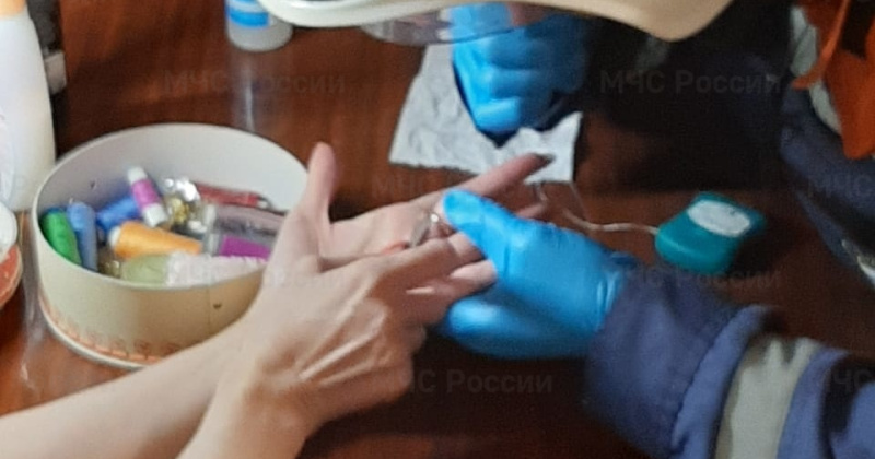 Спасатели избавили палец магаданки от сдавившего кольца