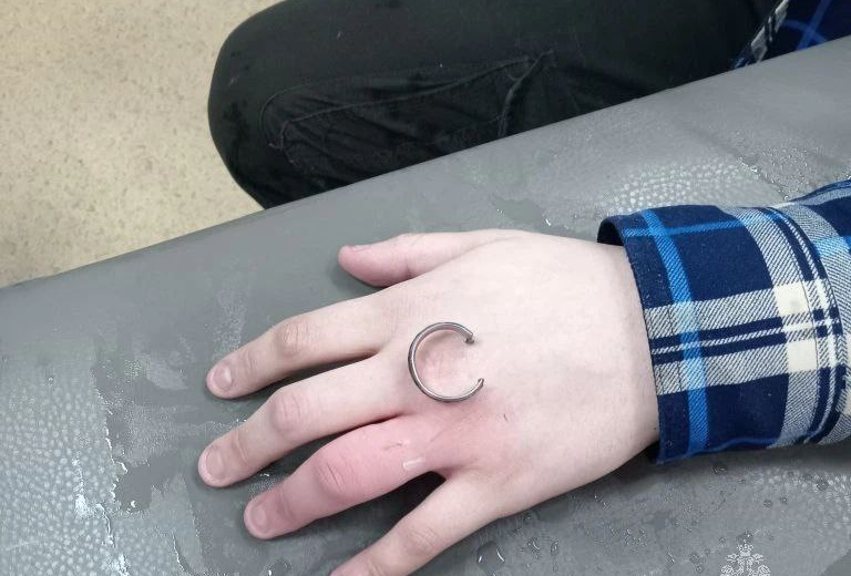 Магаданские спасатели дважды оказывали помощь в снятии колец с пальцев